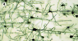 Нервова тканина