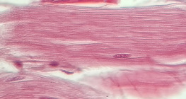 Сухожилля (повздовжній переріз)