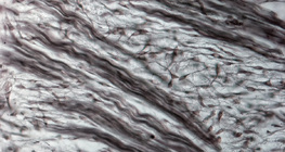 Волокниста хрящова тканина (ніс ембріона свині)