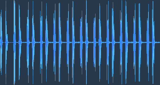 Нормальний звук серця