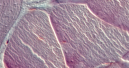 Сухожилля (поперечний переріз)