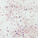 Tetanus bacteria