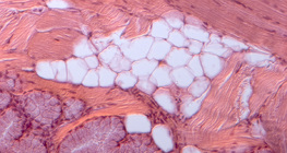 Жирова тканина