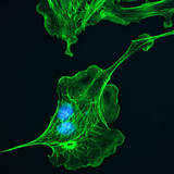 Цитоскелет