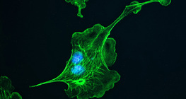 Цитоскелет