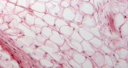 Жирова тканина