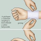 Fedőkötés készítése 