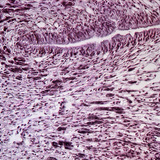 Поперечний переріз ноги равлика