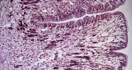 Поперечний переріз ноги равлика