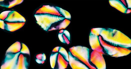 Крохмальні гранули в картоплі (поляризаційний знімок)