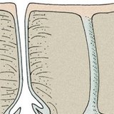 Залози шкіри: сальні залози