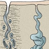 Залози шкіри: потові залози
