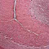 Розріз людського мозочка