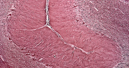 Розріз людського мозочка