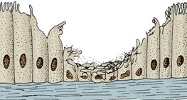 Війчастий епітелій дихальних шляхів курця