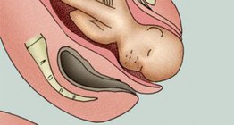 Народження