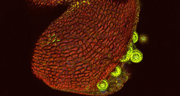 Відкриття пилкового мішка квітки Мірабіліса (вигляд через конфокальний лазерний мікроскоп)