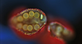 Відкриття пилкового мішка квітки Мірабіліса (вигляд через оптичний мікроскоп)