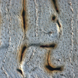 Поздовжній переріз кістки