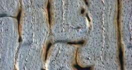 Поздовжній переріз кістки