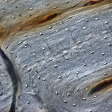 Поздовжній переріз кістки