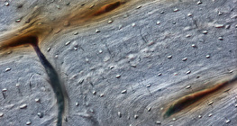 Поздовжній переріз кістки