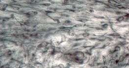 Пухка сполучна тканина