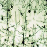 Нейрони кори головного мозку