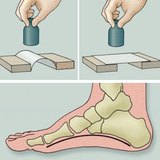 Дослідження дуги стопи