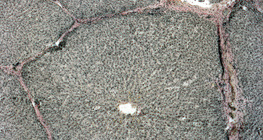 Розріз печінки (свині)