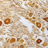 Нервові клітини спінального ганглія