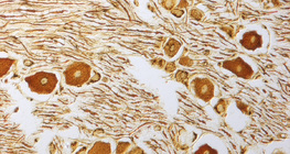 Нервові клітини спінального ганглія