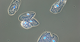 Клітини слизової, що вистилає ротову порожнину людини