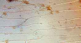 Клітини внутрішньої м'ясистої луски цибулини ріпчастої цибулі