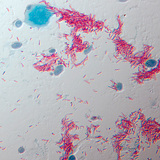 Збудник туберкульозу (Mycobacterium tuberculosis)