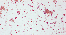 Збудник гонореї (Neisseria gonorrhoeae)
