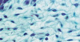 Пухка сполучна тканина