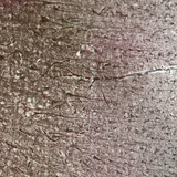 Кора головного мозку людини: видно різні клітинні шари