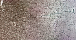 Кора головного мозку людини: видно різні клітинні шари