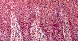 Поперечний переріз людського язика