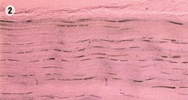 Щільна сполучна тканина сухожилля