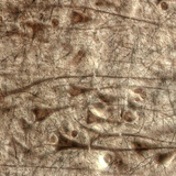 Кора головного мозку людини з гігантськими пірамідальними клітинами