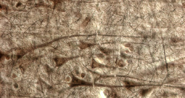 Кора головного мозку людини з гігантськими пірамідальними клітинами