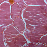 Розріз щитовидної залози