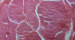 Розріз щитовидної залози