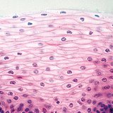 Багатошаровий плоский незроговілий епітелій