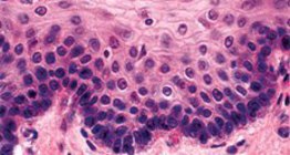 Багатошаровий плоский незроговілий епітелій