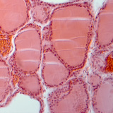 Щитовидна залоза в розрізі