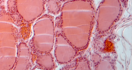 Щитовидна залоза в розрізі