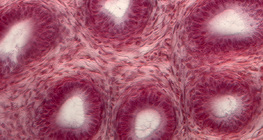 Поперечний розріз сім'яних канальців яєчка